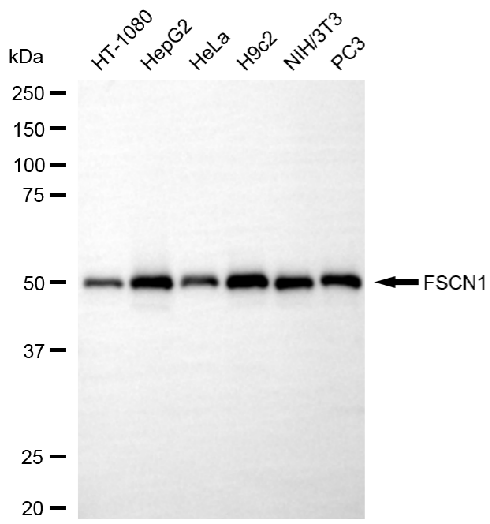 [KD Validated] Anti-FSCN1 Rabbit mAb [68H13N69]