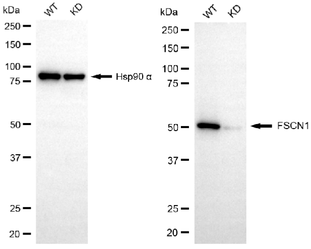 [KD Validated] Anti-FSCN1 Rabbit mAb [68H13N69]