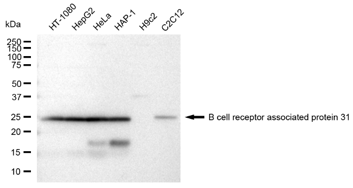 [KD Validated] Anti-BCAP31 Rabbit mAb [73S65A90]