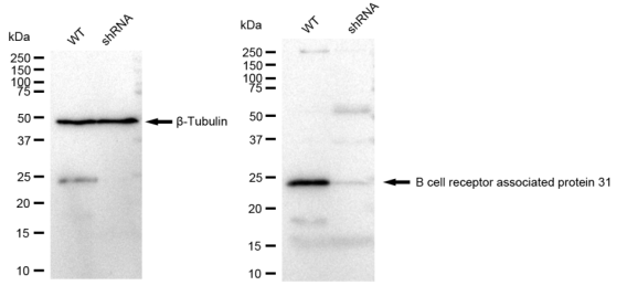 [KD Validated] Anti-BCAP31 Rabbit mAb [73S65A90]
