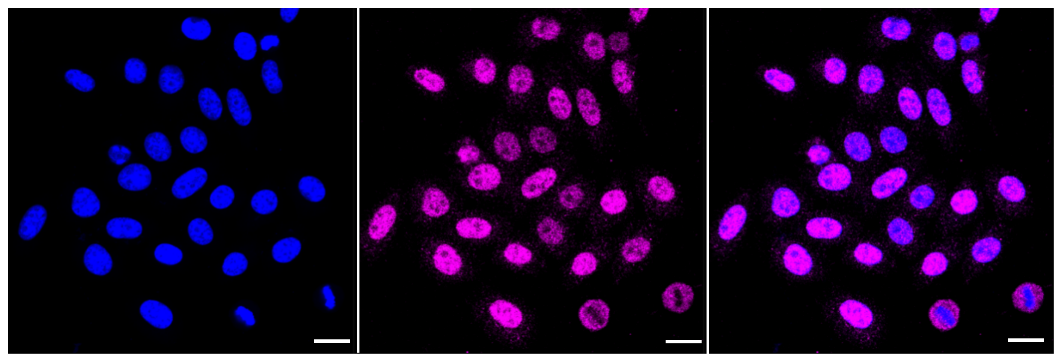 [KD Validated] Anti-CSNK2B Rabbit mAb [25L27O56]