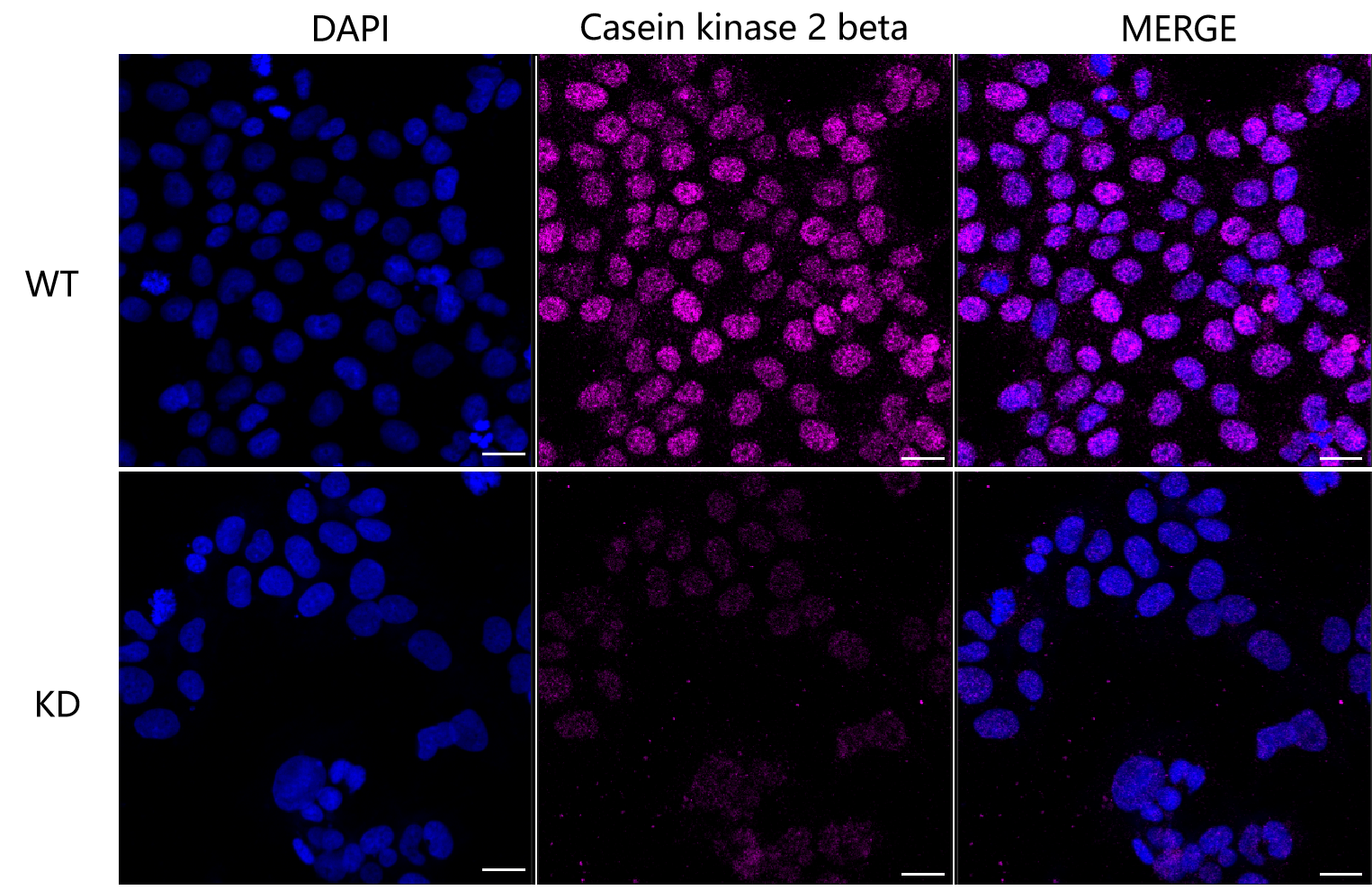 [KD Validated] Anti-CSNK2B Rabbit mAb [25L27O56]