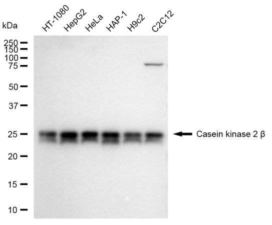[KD Validated] Anti-CSNK2B Rabbit mAb [25L27O56]