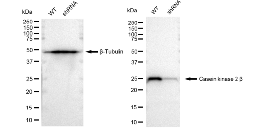 [KD Validated] Anti-CSNK2B Rabbit mAb [25L27O56]