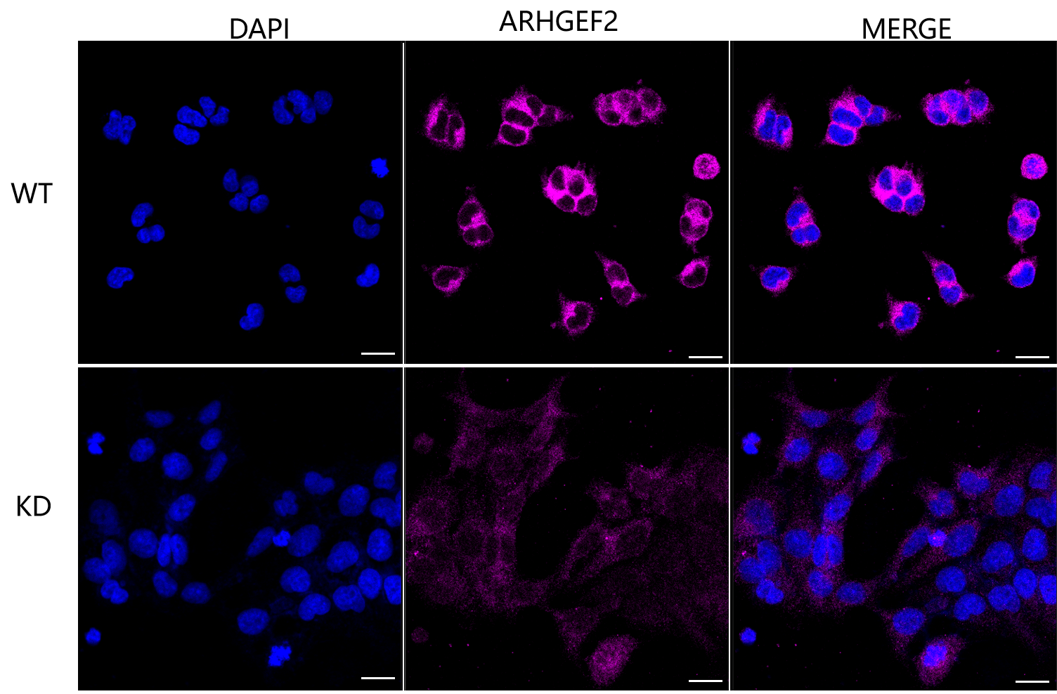 [KD Validated] Anti-ARHGEF2 Rabbit mAb [57E18J84]