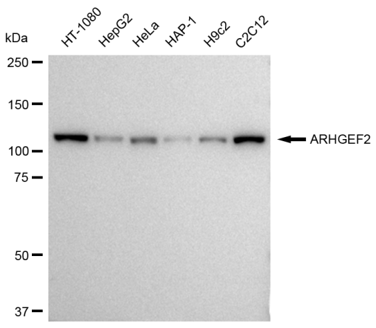 [KD Validated] Anti-ARHGEF2 Rabbit mAb [57E18J84]
