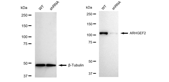 [KD Validated] Anti-ARHGEF2 Rabbit mAb [57E18J84]
