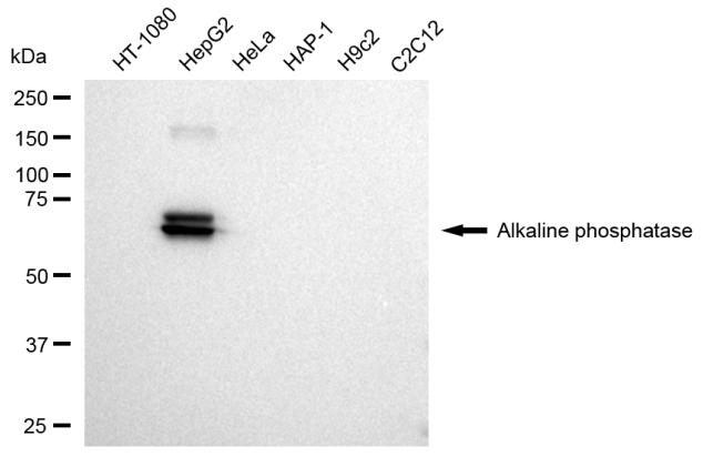 [KD Validated] Anti-ALPI Rabbit mAb [58G23B97]