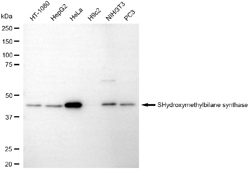 [KD Validated] Anti-HMBS Rabbit mAb [88E83J07]