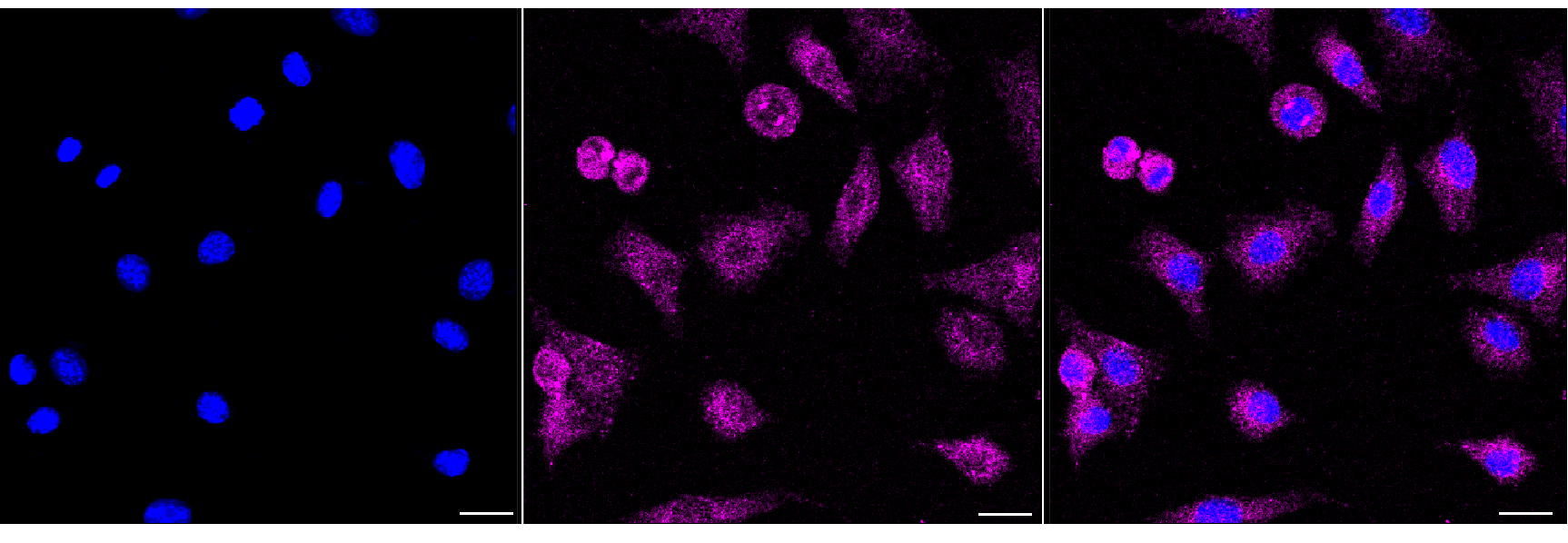 [KD Validated] Anti-HIP1 Rabbit mAb [60O91Q67]