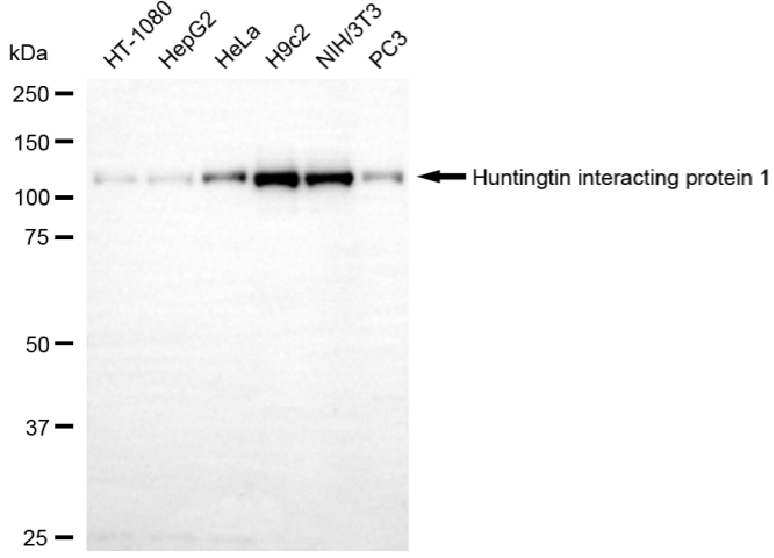 [KD Validated] Anti-HIP1 Rabbit mAb [60O91Q67]