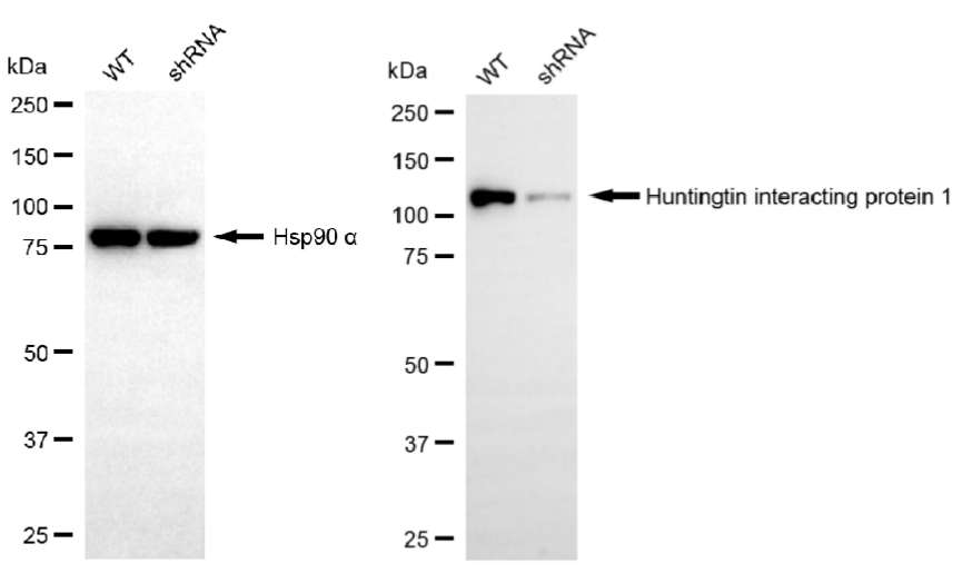 [KD Validated] Anti-HIP1 Rabbit mAb [60O91Q67]