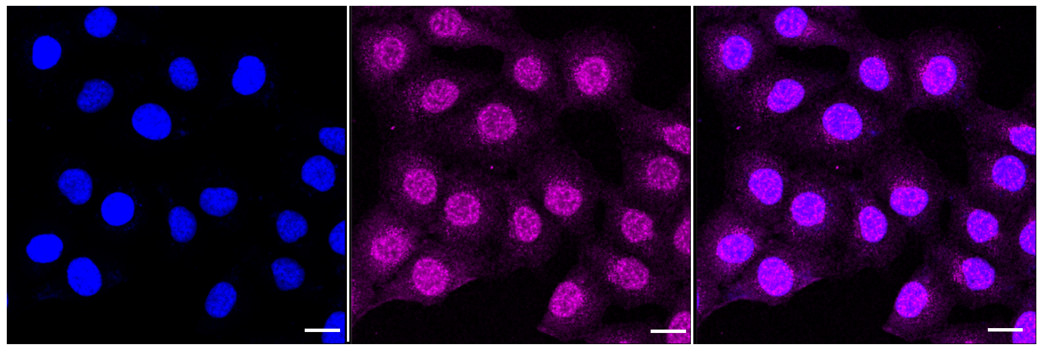[KD Validated] Anti-CAPN2 Rabbit mAb [10K43C12]