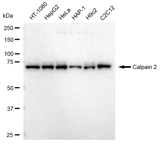 [KD Validated] Anti-CAPN2 Rabbit mAb [10K43C12]