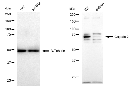 [KD Validated] Anti-CAPN2 Rabbit mAb [10K43C12]