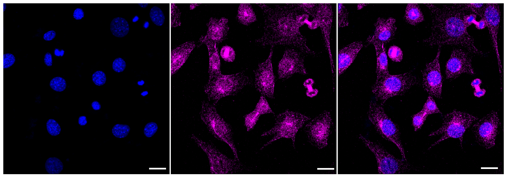 [KD Validated] Anti-CAPN1 Rabbit mAb [60A96B60]