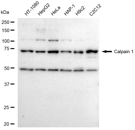 [KD Validated] Anti-CAPN1 Rabbit mAb [60A96B60]
