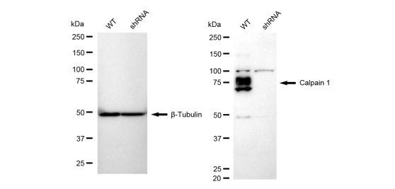 [KD Validated] Anti-CAPN1 Rabbit mAb [60A96B60]