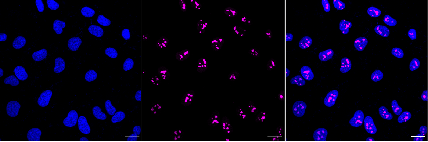 [KD Validated] Anti-CDKN2A Rabbit mAb [28S48S74]