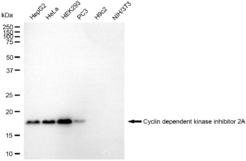 [KD Validated] Anti-CDKN2A Rabbit mAb [28S48S74]