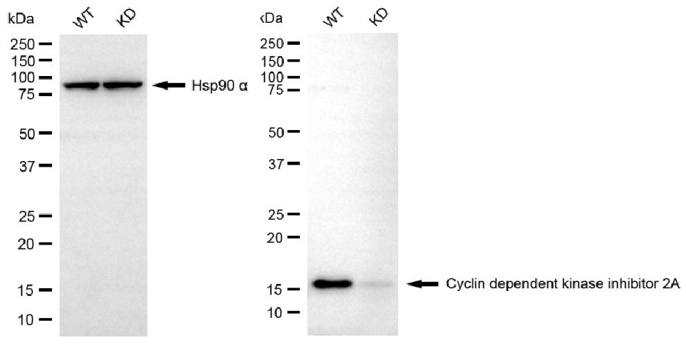 [KD Validated] Anti-CDKN2A Rabbit mAb [28S48S74]