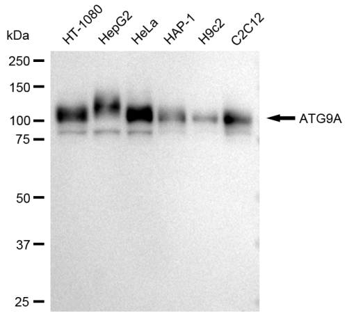 [KD Validated] Anti-ATG9A Rabbit mAb [66N10B31]