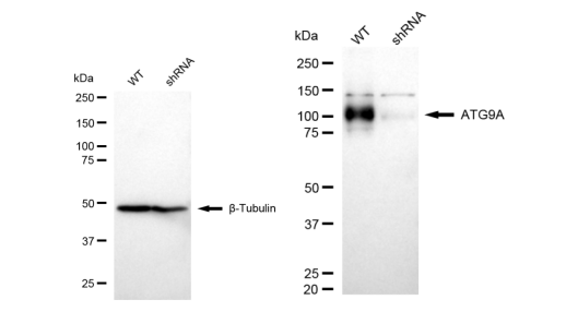 [KD Validated] Anti-ATG9A Rabbit mAb [66N10B31]