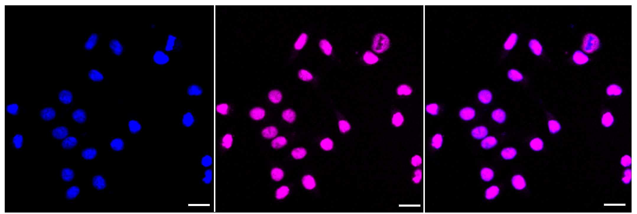 [KD Validated] Anti-CHEK2 Rabbit mAb [31B27N90]
