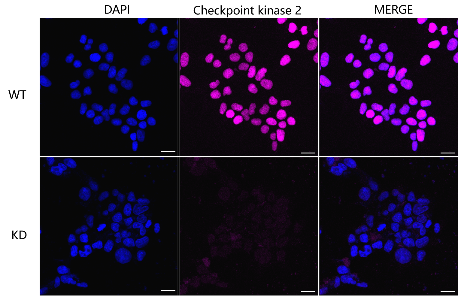 [KD Validated] Anti-CHEK2 Rabbit mAb [31B27N90]
