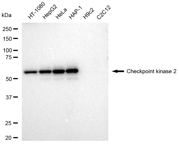 [KD Validated] Anti-CHEK2 Rabbit mAb [31B27N90]