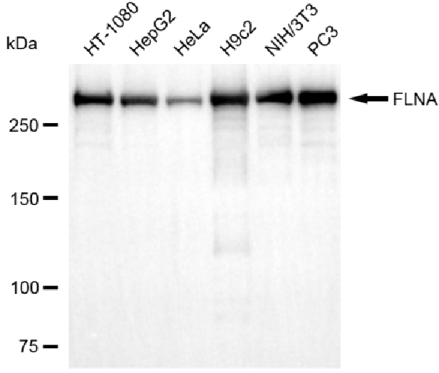 [KD Validated] Anti-FLNA Rabbit mAb [36P28A28]