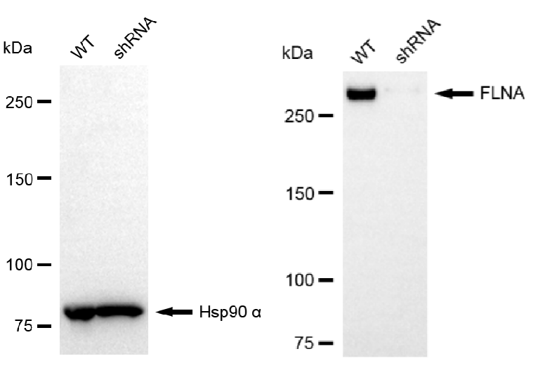 [KD Validated] Anti-FLNA Rabbit mAb [36P28A28]