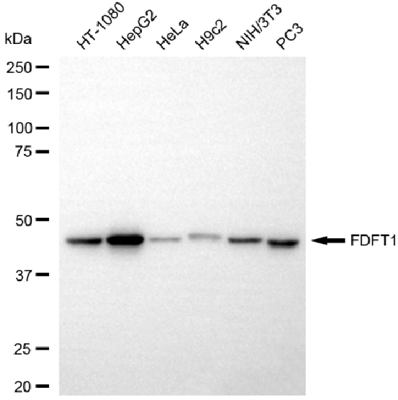[KD Validated] Anti-FDFT1 Rabbit mAb [85C54A49]