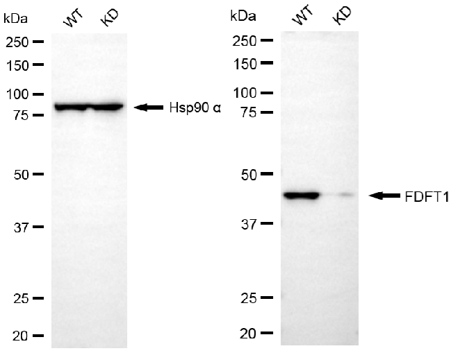 [KD Validated] Anti-FDFT1 Rabbit mAb [85C54A49]