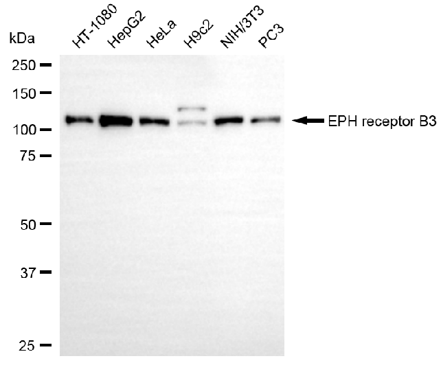 [KD Validated] Anti-EPHB3 Rabbit mAb [82S92C06]