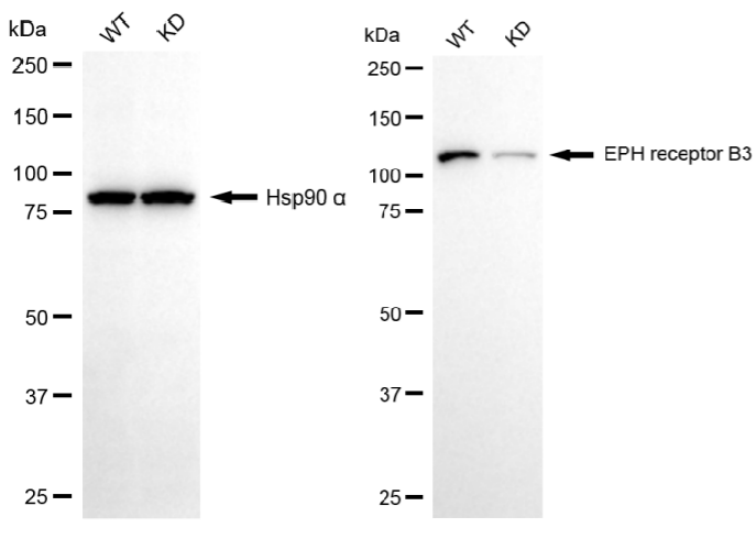 [KD Validated] Anti-EPHB3 Rabbit mAb [82S92C06]