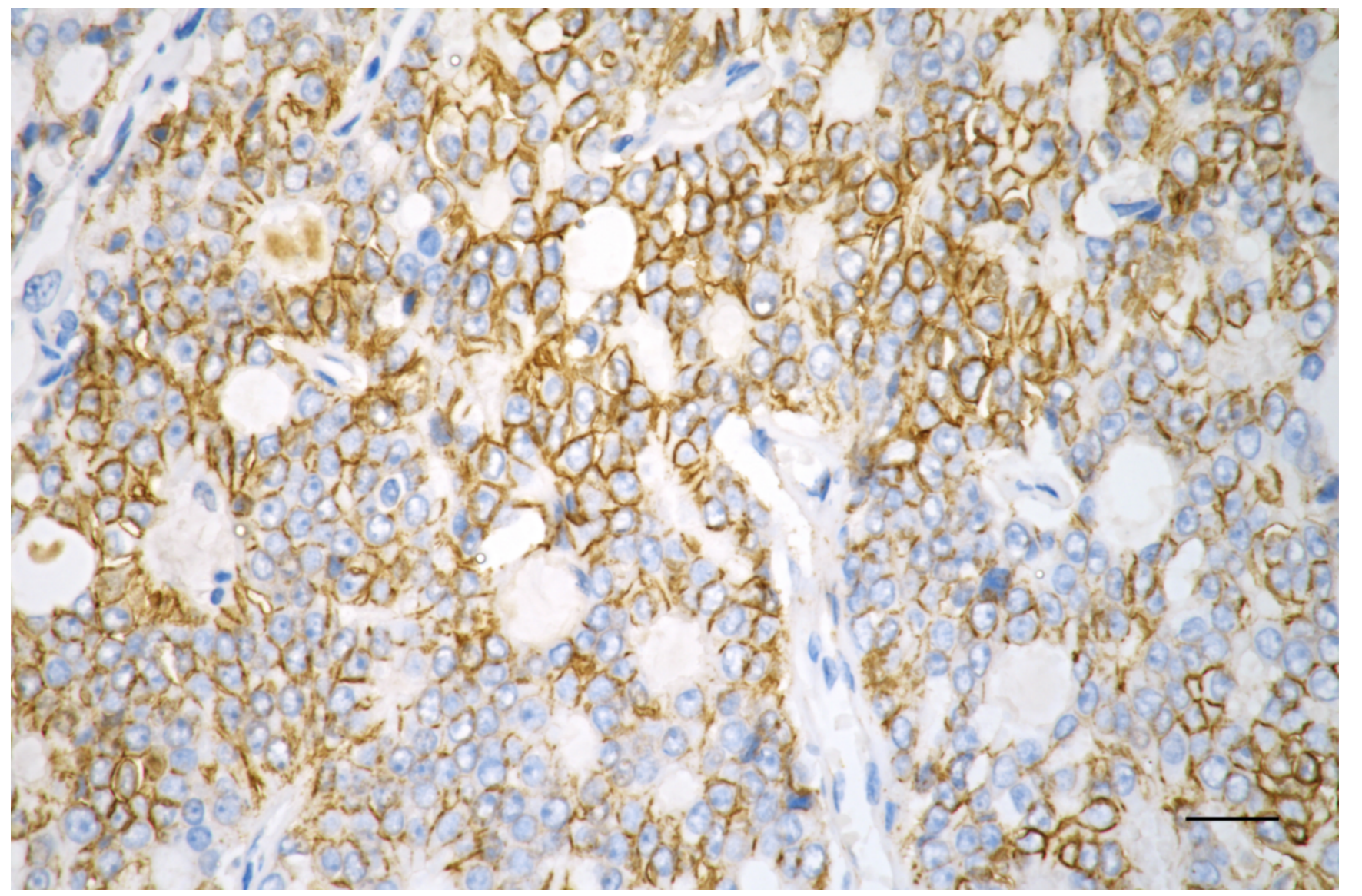 [KD Validated] Anti-CTNND1 Rabbit mAb [49L78T22]