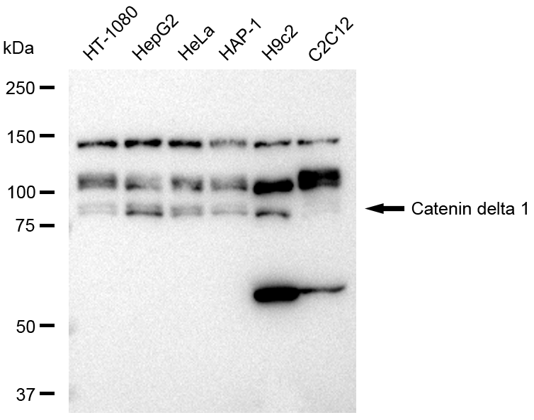 [KD Validated] Anti-CTNND1 Rabbit mAb [49L78T22]