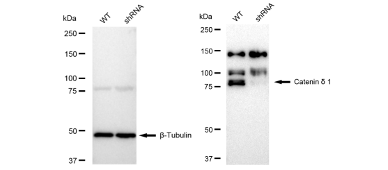 [KD Validated] Anti-CTNND1 Rabbit mAb [49L78T22]