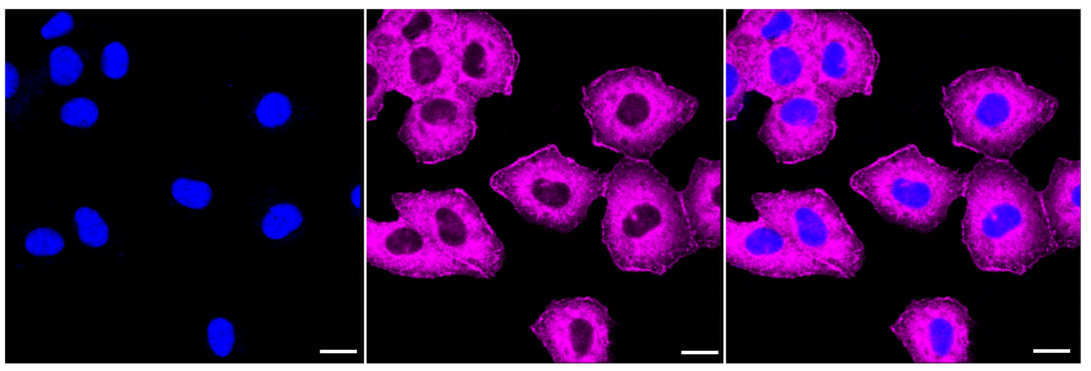 [KD Validated] Anti-CAP1 Rabbit mAb [11A51C24]