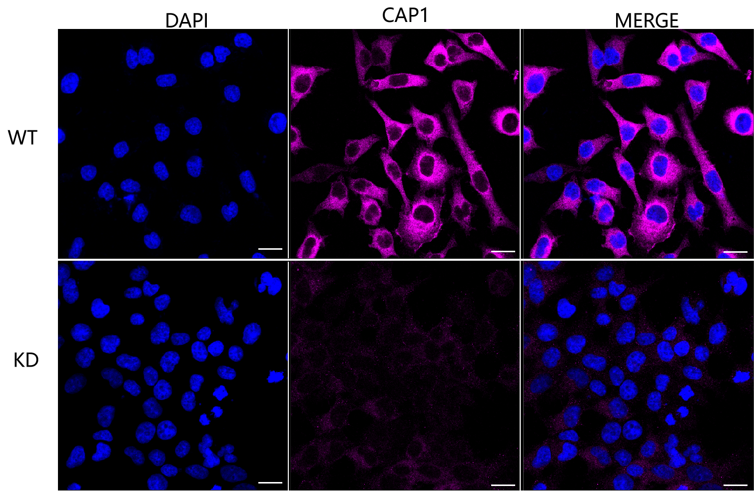 [KD Validated] Anti-CAP1 Rabbit mAb [11A51C24]