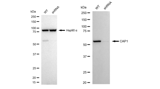 [KD Validated] Anti-CAP1 Rabbit mAb [11A51C24]