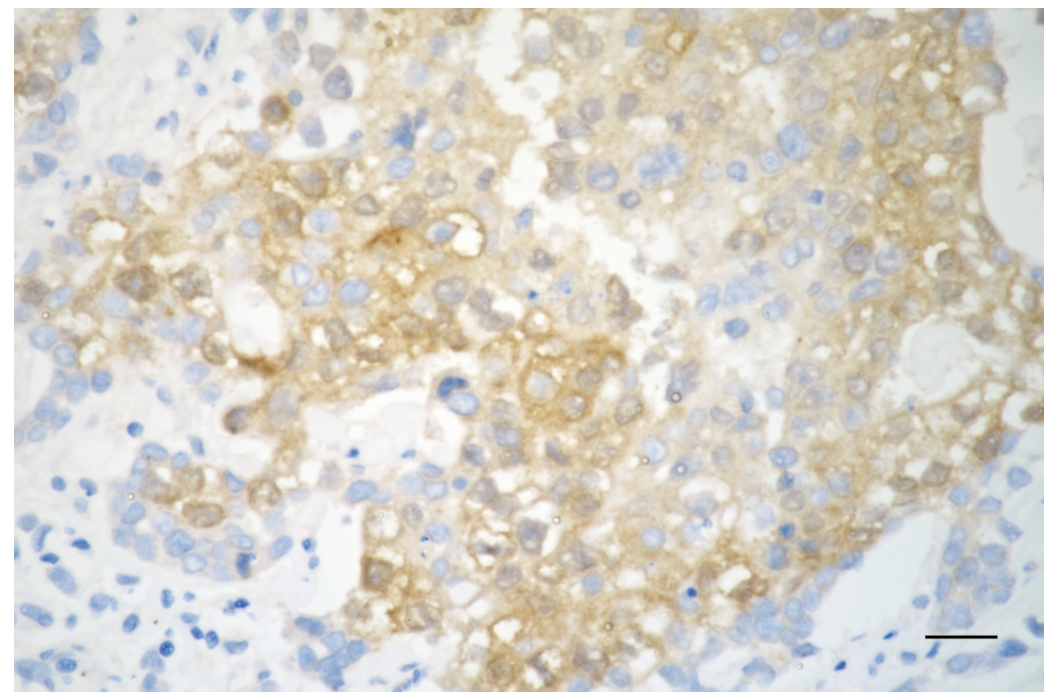[KD Validated] Anti-ACACA Rabbit mAb [61D03B02]