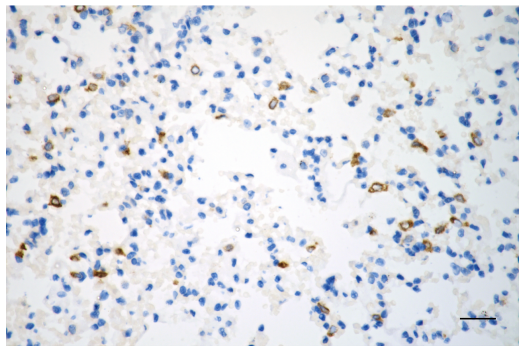 [KD Validated] Anti-ACACA Rabbit mAb [61D03B02]