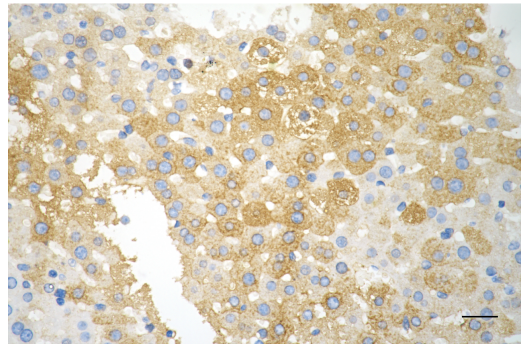 [KD Validated] Anti-ACACA Rabbit mAb [61D03B02]