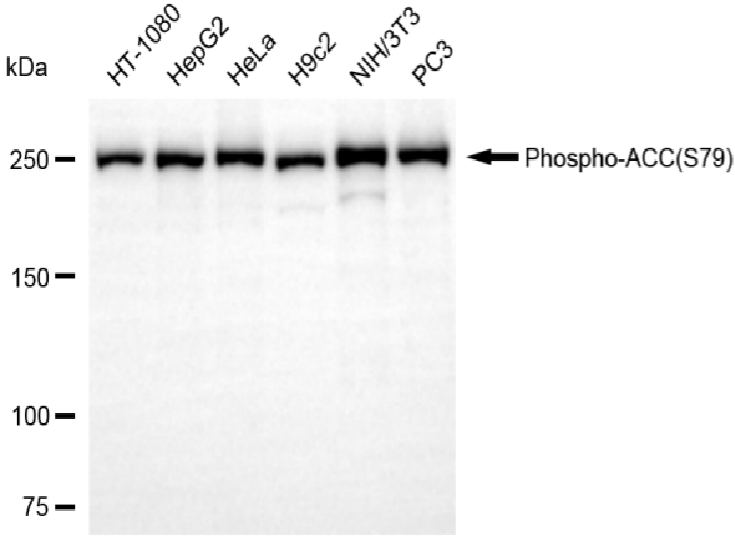 [KD Validated] Anti-ACACA Rabbit mAb [61D03B02]
