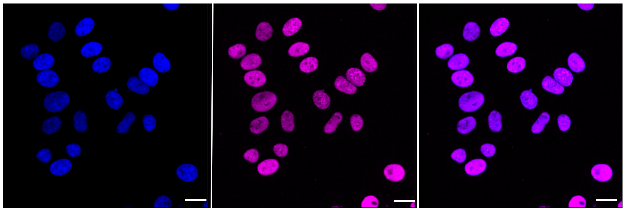 [KD Validated] Anti-CHAF1A Rabbit mAb [33G70M61]
