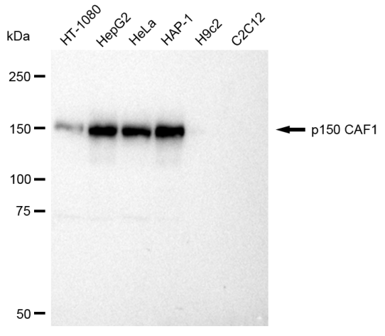[KD Validated] Anti-CHAF1A Rabbit mAb [33G70M61]