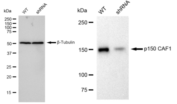 [KD Validated] Anti-CHAF1A Rabbit mAb [33G70M61]