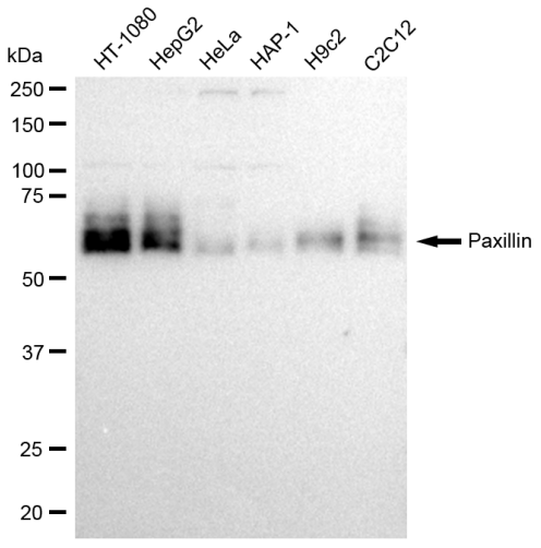 [KD Validated] Anti-PXN Rabbit mAb [89F34C75]